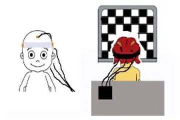 Diagram of visual evoked potential