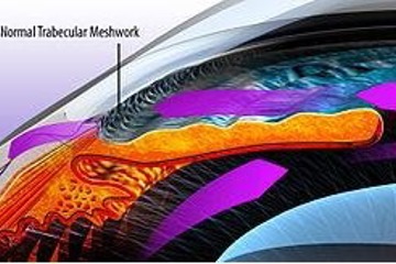 Diagram of a normal trabecular meshwork