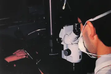 Professor Gartry performing the very first excimer laser PRK treatment in the UK in November 1989.