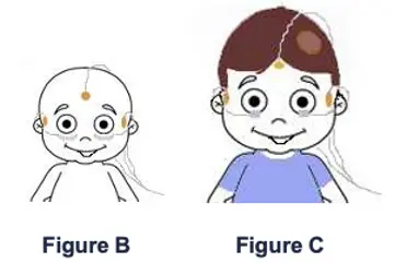 Diagram of electroretinogram for children