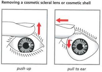 Diagram showing how to remove a cosmetic shell