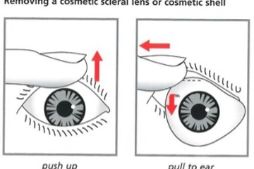 Removing A Cosmetic Shell